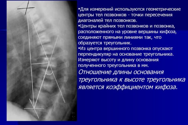 При входе на кракен пишет вы забанены